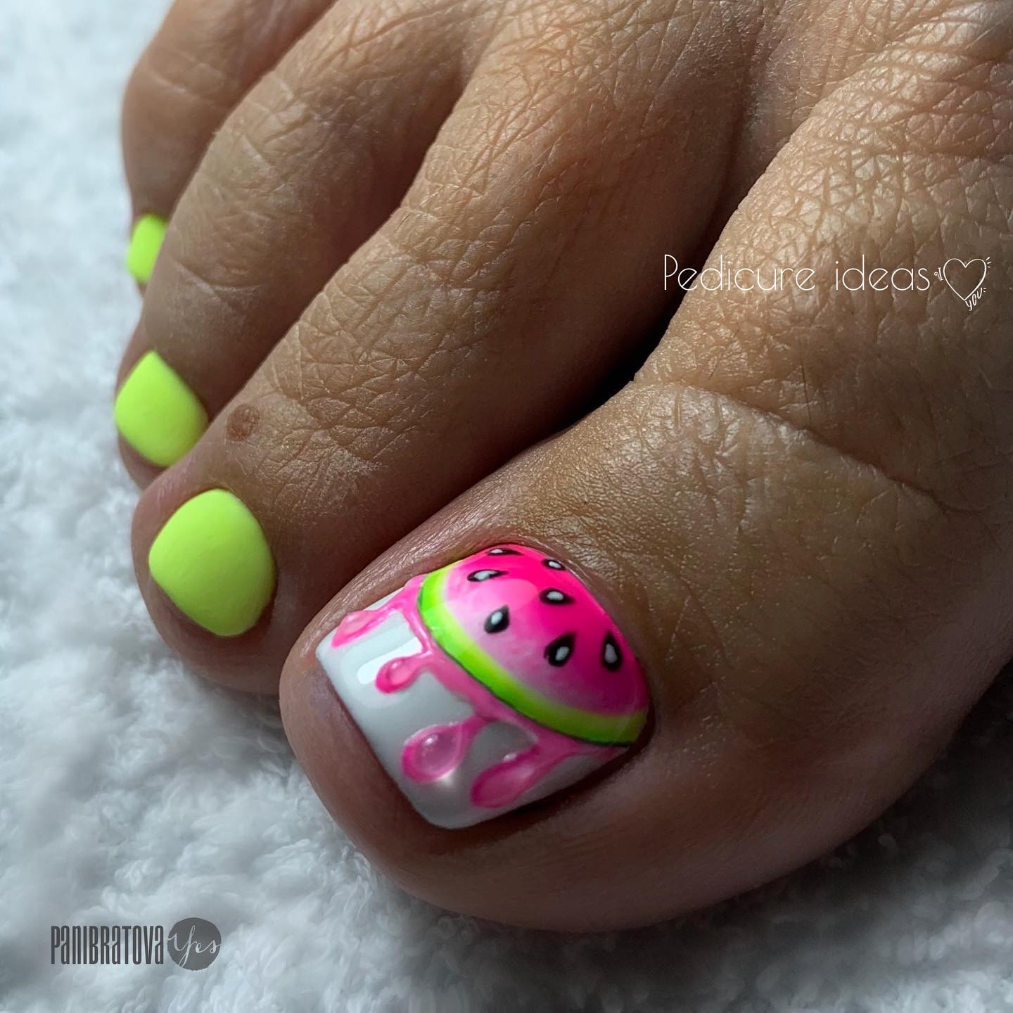 Bright Green Toe Nails with Watermelon Design on Big Toe